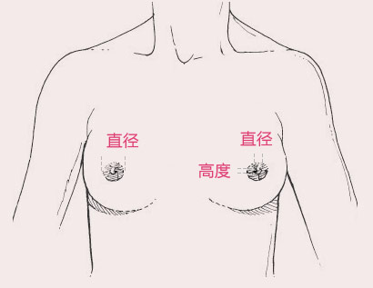 乳头形态的黄金比例